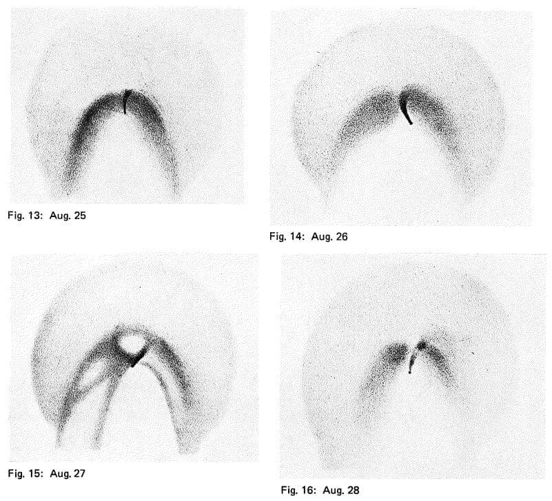 Comet Swift–Tuttle — Comet Swift-Tuttle 1862 III by Julius Schmidt (Aug. 21 - Aug. 28)