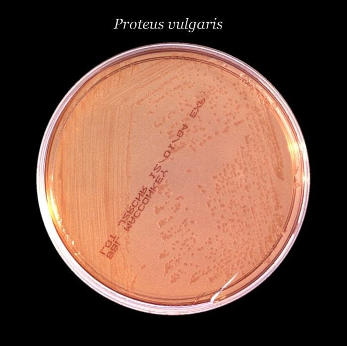 Proteus — Proteus McConkey